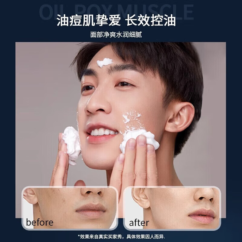 MKAK男士水乳套装补水保湿清爽控油滋润不腻去角质洗面奶maka油肌专研 1瓶装【MKAK控油洗面奶140g】