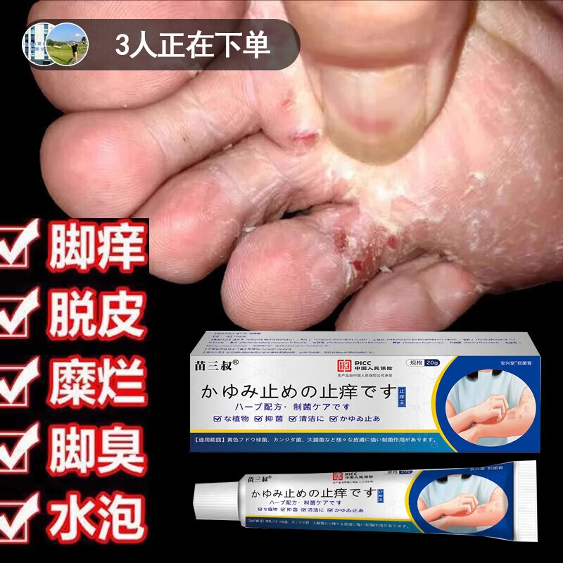 乙氧苯柳安胺软膏【日本止痒王】快速皮肤干痒外用痒抑乳膏菌 【买二送一 超值】发三条 官正方品旗舰自大药房营