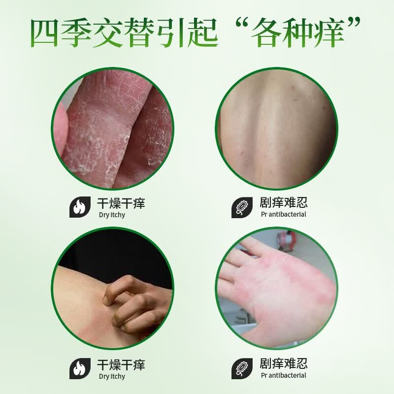 云南本草抑菌膏皮肤瘙痒软膏肛门瘙痒膏大腿根内测潮湿瘙痒20g 1盒【默认发新包装】
