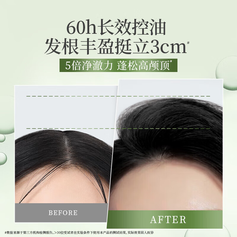 滋源无患子控油清爽洗发水洗发露去屑止痒无硅油强根蓬松男女士洗头膏 控油清爽洗发水共500ml