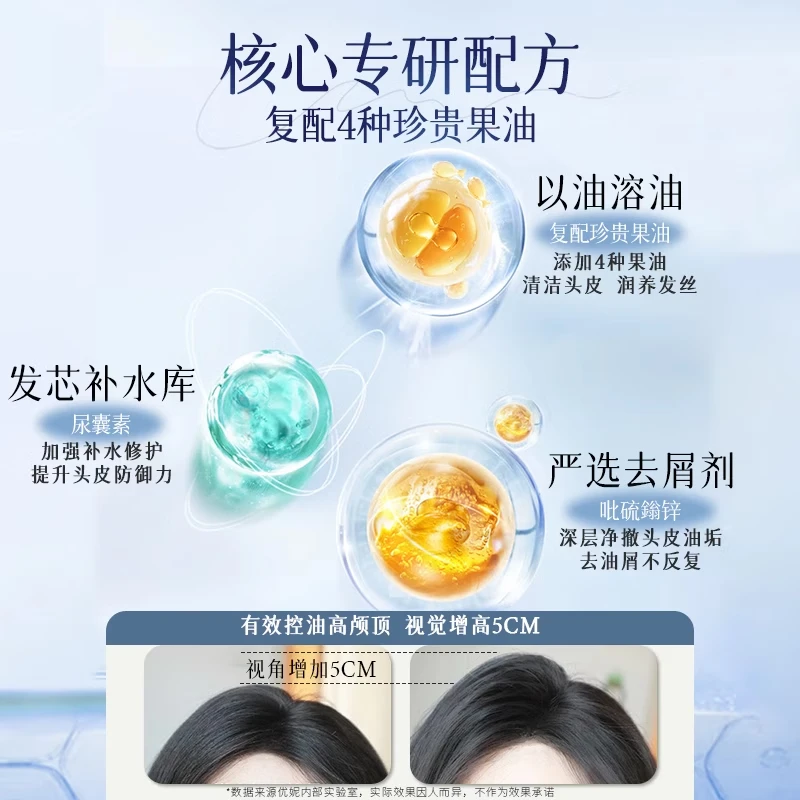 优妮果油氨基酸洗发水女士护发素发膜洗发乳清爽控油去屑止痒滋润修护 【洗发水】清爽控油洗发乳800ml