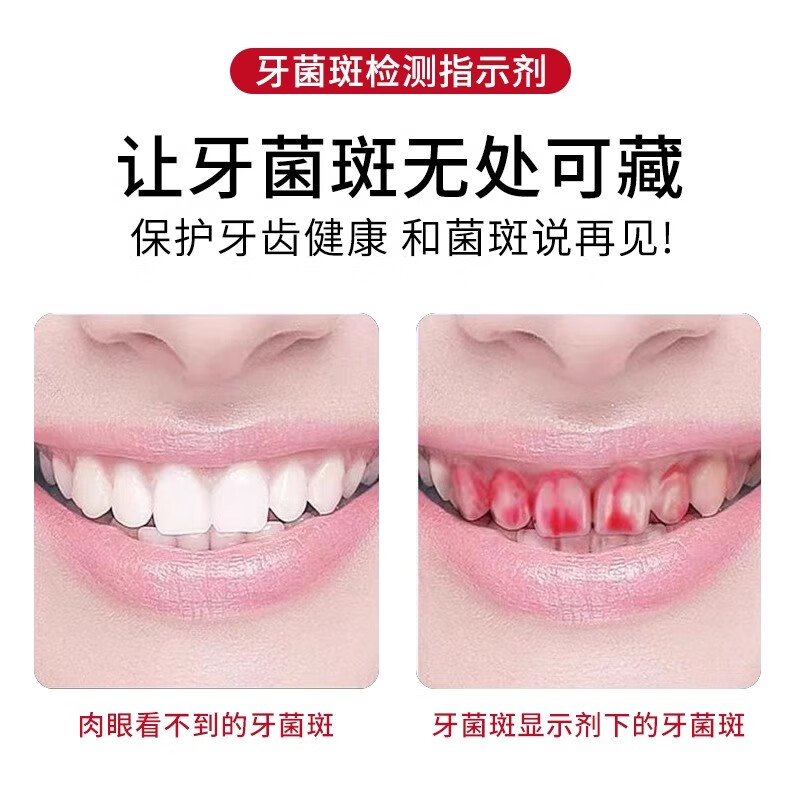 优利特儿童牙菌斑显示剂指示剂口腔测试祛除牙膏染色剂 60ml菌斑指示剂*3瓶