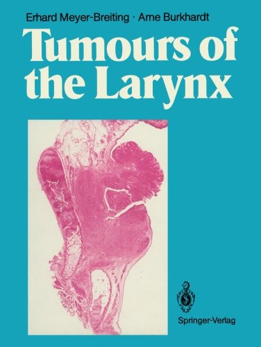 预订 tumours of the larynx