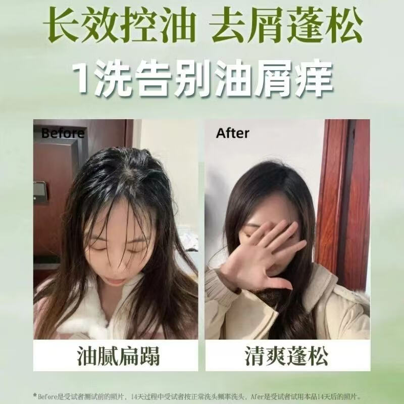 春蔻氨基酸控油蓬松洗发水500ml止痒去屑洗发膏露洗头膏持久留香男女 【超值组合】两瓶洗发水500ml*2 -去屑控油柔顺止痒-