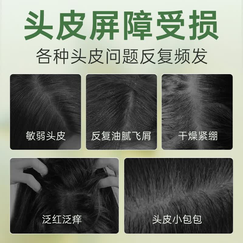 百年扁氏艾草去屑止痒头皮素 天然植萃洗发水柔和洁净控油改善头皮洗发水 买1送1