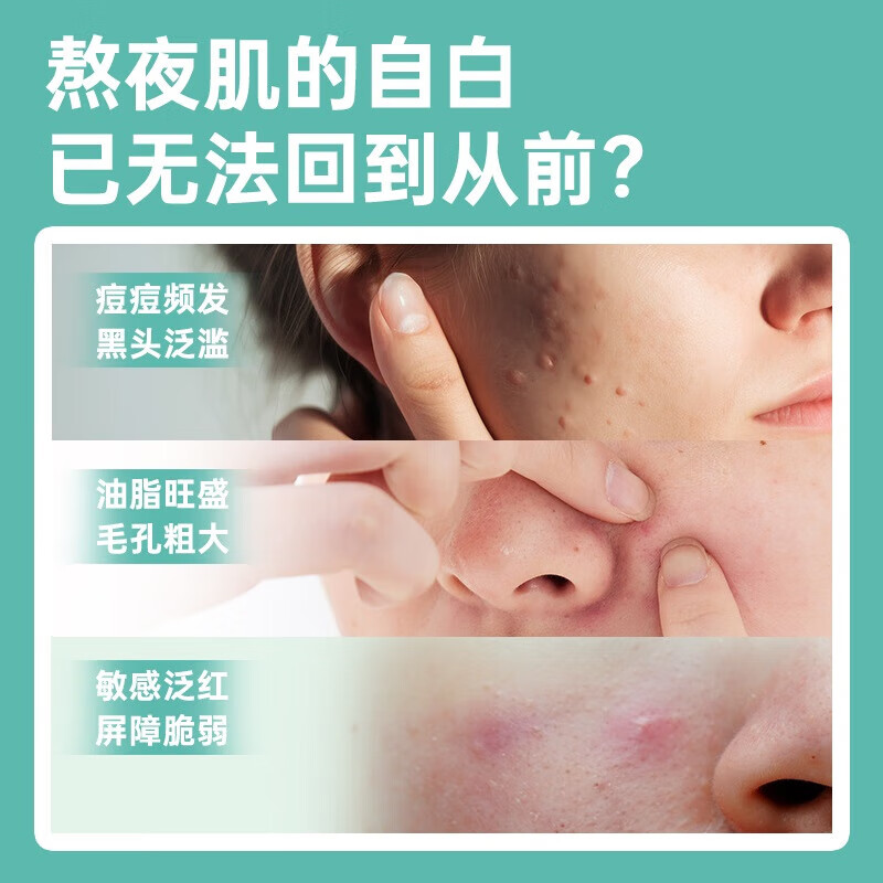OLLY亮肤祛痘印闭口美白肌肤去瑕软糖50粒+女性维生素升级版70粒*1瓶 肌肤去瑕软糖 50粒*1瓶