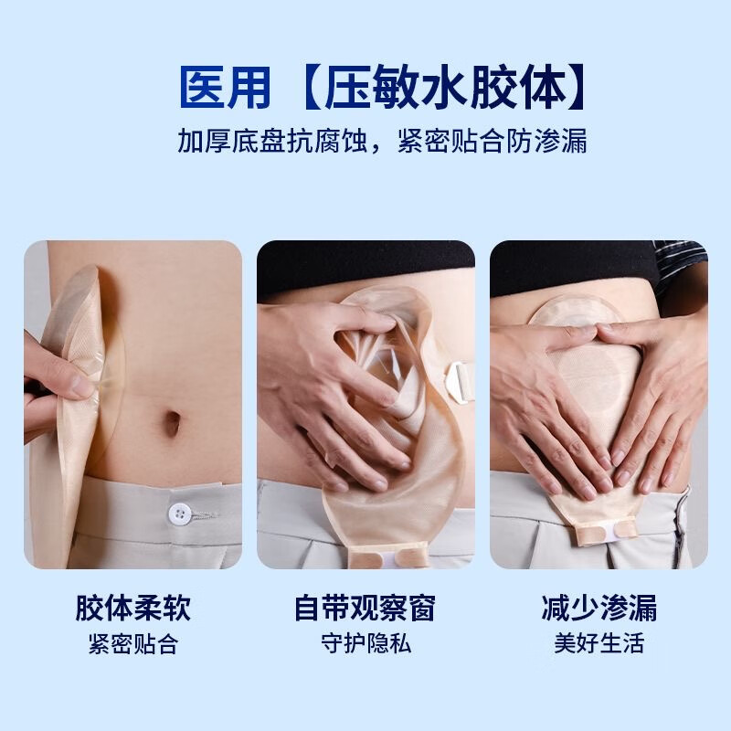 护士同学一件式微凸面造口袋15202医用凸底盘可自动排气除臭一次性造瘘袋 自带活性炭款【10片装】微凸底盘+送防漏圈10个