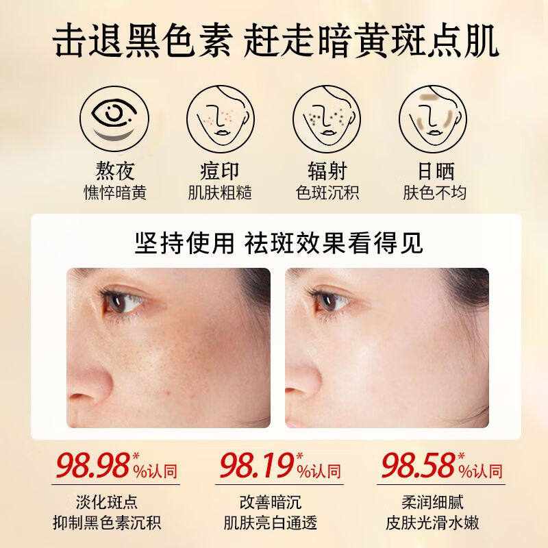 军博仕美白祛斑精华霜 淡化色斑雀斑 改善暗沉 提亮控油面霜护肤品男女 军博仕美白祛斑精华霜 30g