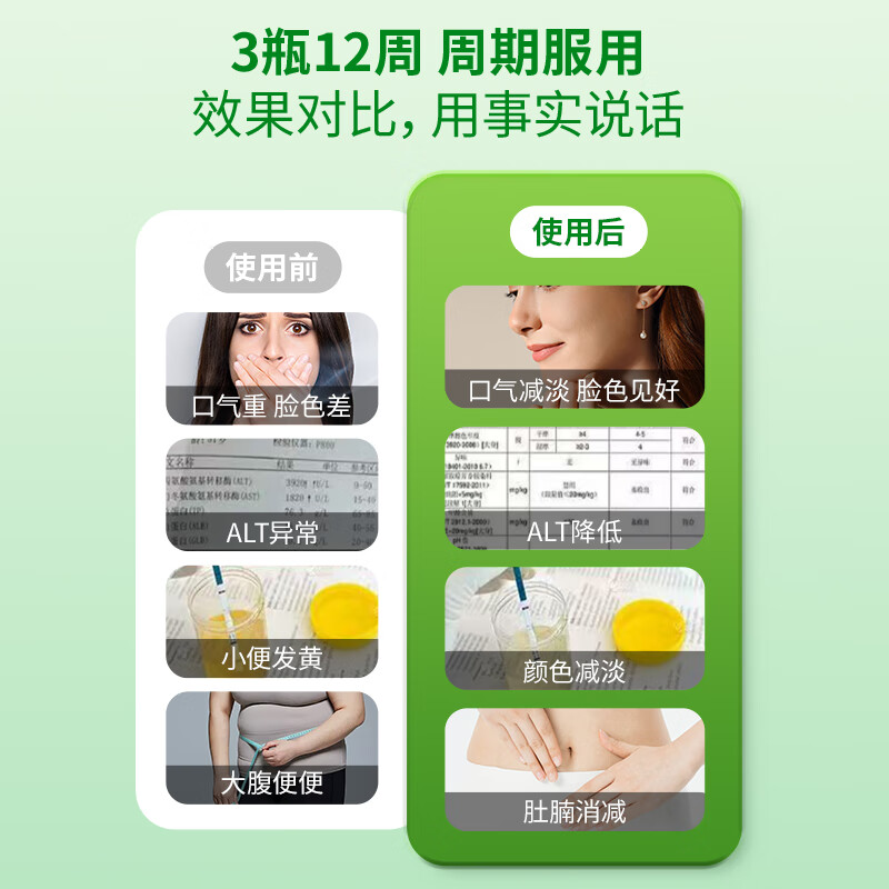 BUIQO奶蓟草护肝片水飞蓟人参葛根咀嚼片养肝护肝喝酒熬夜脂肪肝肚子大 5瓶（重度调养，疗程推荐）