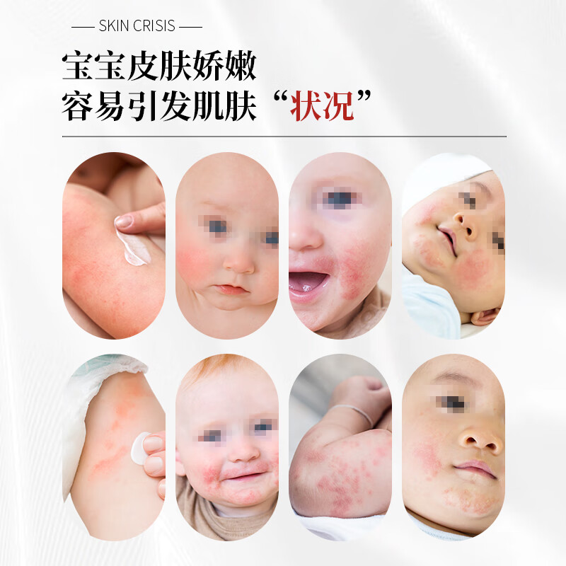 初敏旗舰店神经酰胺舒缓乳液新生儿宝宝乳霜面霜儿童保湿滋润干痒红 【亲肤无敏】舒缓乳液+多效霜