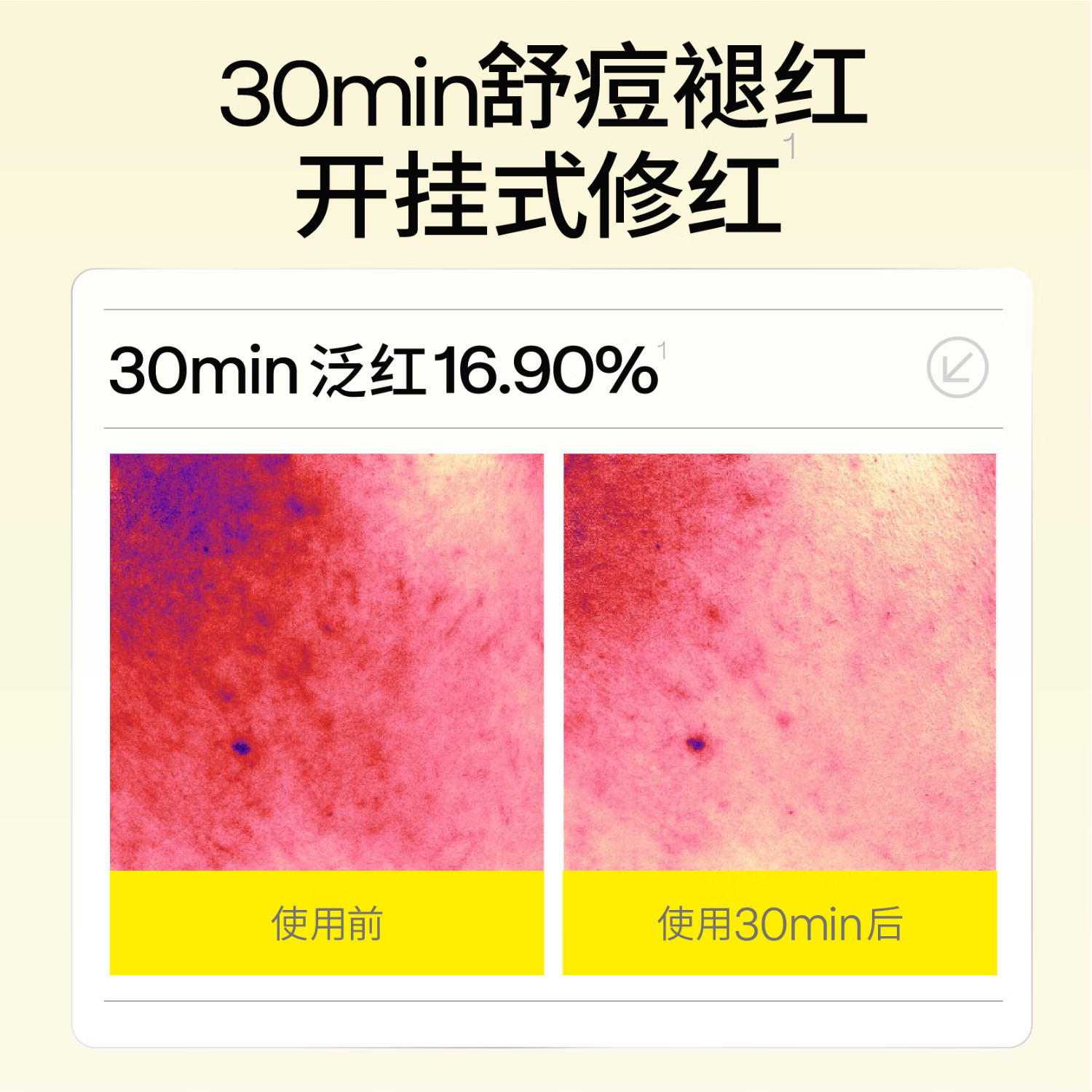 羽素祛痘安肌修护反复痘精华保湿控油痘痘肌全脸可用 【提亮+淡印】淡印精华8ml