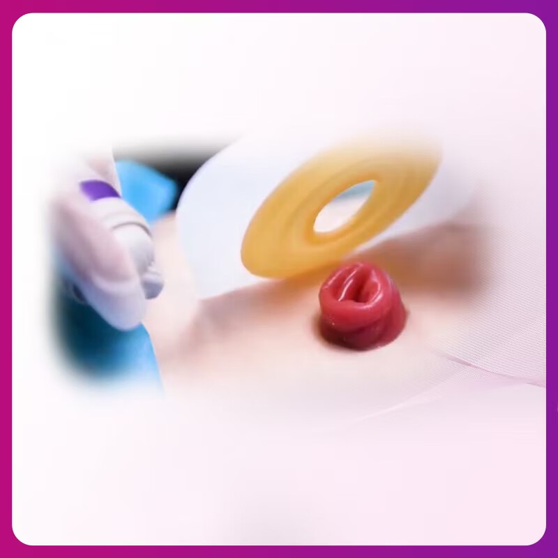 康维德（CONVATEC）粘胶剥离剂423289造口附件护理用品 轻松祛除多种粘胶 423289粘胶剥离剂（50ml）