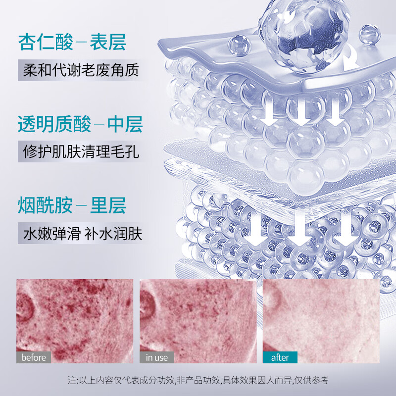 梵贞杏仁酸净透抛光精华液祛痘修护保湿改善暗沉 2瓶/560ml