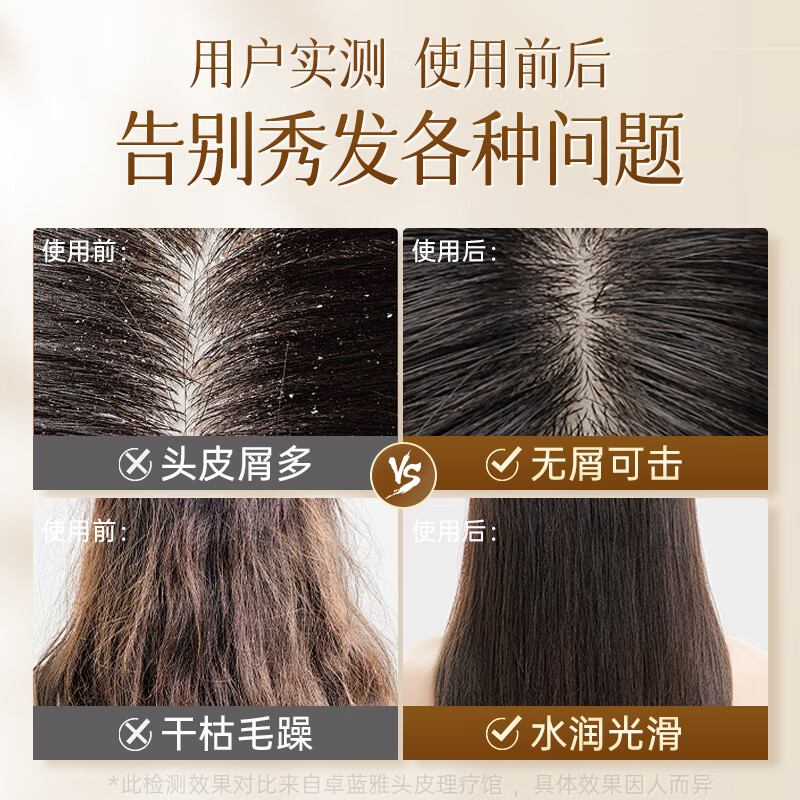 卓蓝雅(ZOOLY)生姜去屑舒缓洗发水400ml原液萃取去屑止痒净透清爽洗发水 去屑洗发水400mL