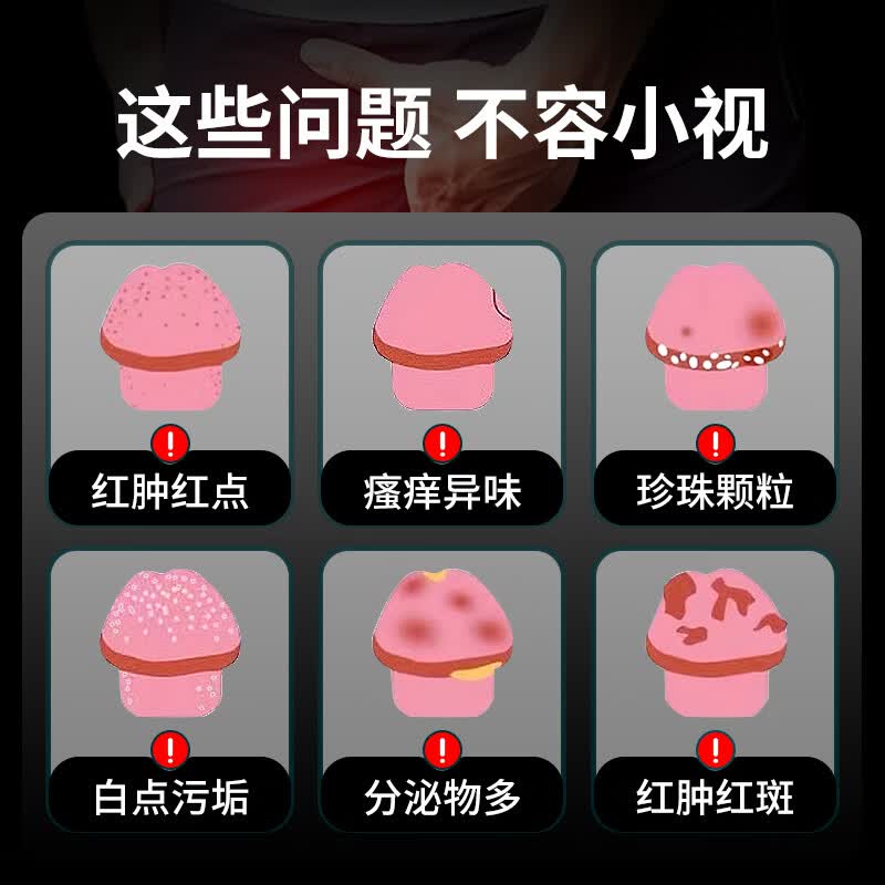 南京同仁堂龟头炎包皮炎喷剂专用Y真菌感染珍珠红肿疹瘙痒异味白垢 3瓶治疗改善型(龟头炎包皮炎) 100%特效龟头炎包皮炎