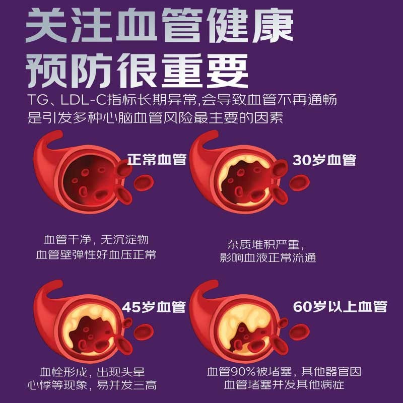 MaggieCare深海鱼油软胶囊99%高纯度EPA 单瓶装 60粒*1瓶