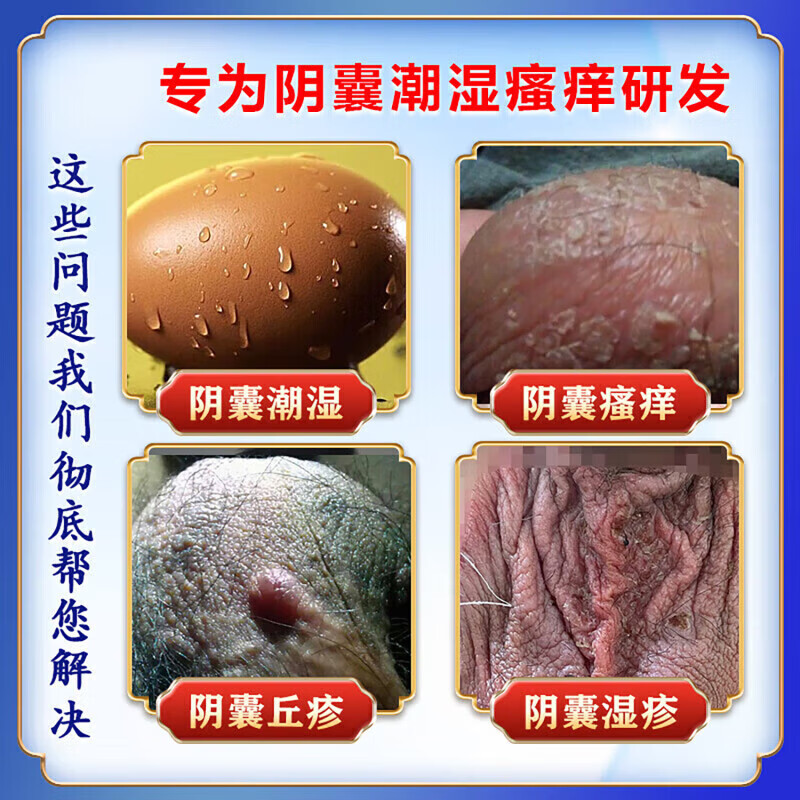 阴囊干燥脱皮瘙痒干裂男人下体私处湿疹止痒私处阴囊痒去潮湿喷剂 私处湿痒特效管用:一盒【乳膏】