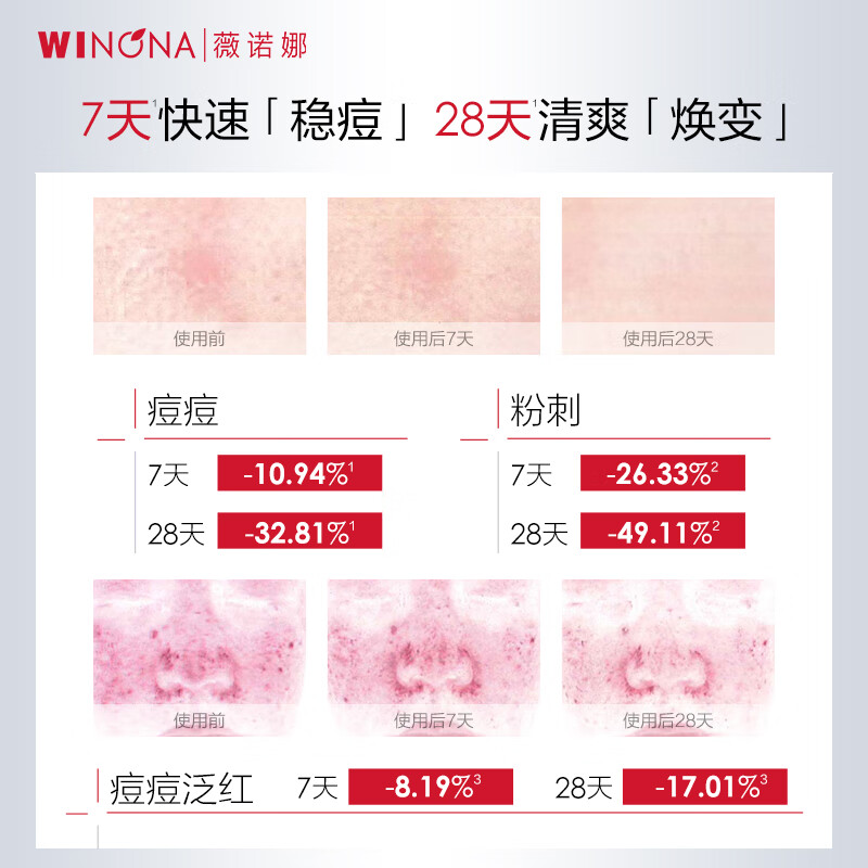 薇诺娜复合水杨酸焕颜精华液2ml*7【效期半年内】祛痘保湿舒缓控油