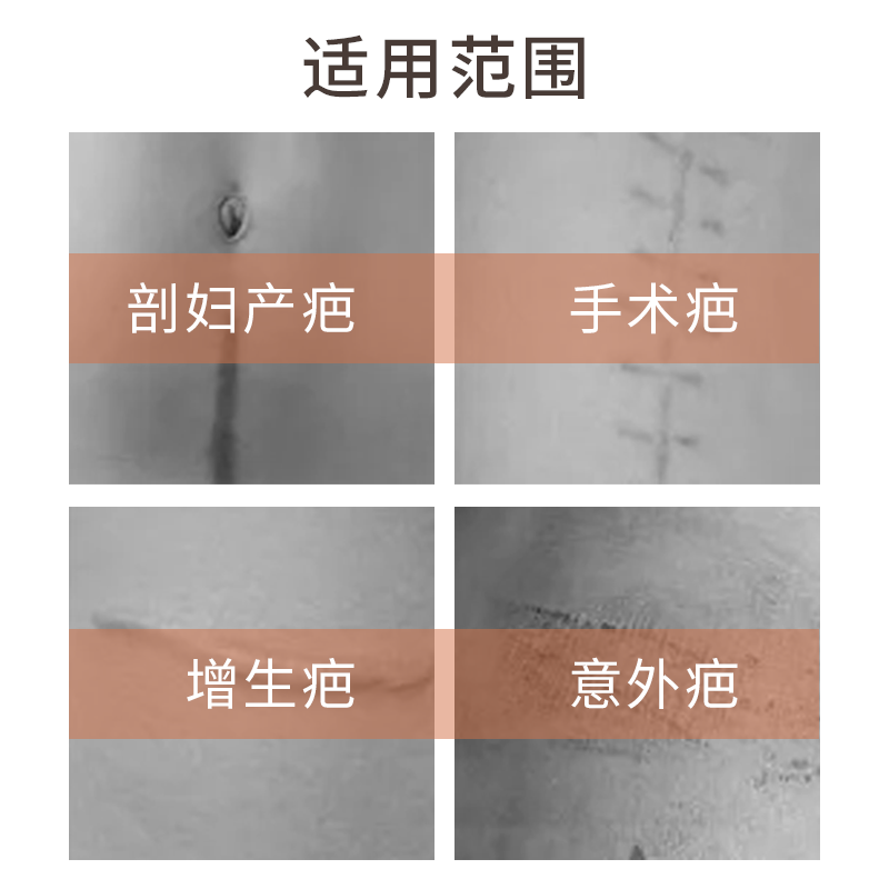 丽森卡疤痕贴无菌剖腹产日抛透气疤痕贴增生 一盒装(3贴)