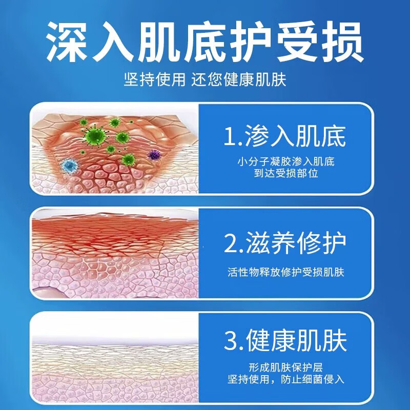 修正肛门潮湿瘙痒专用止痒肛周湿疹有异屎味有分泌物专用红肿疼痛药膏 一盒【体验装】
