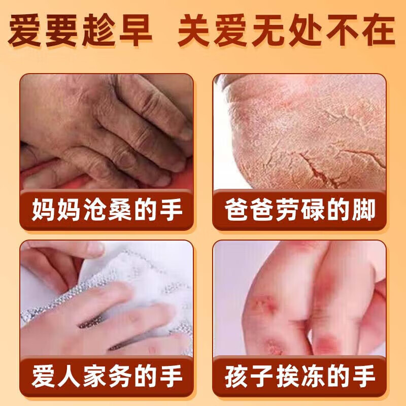 御神堂手裂愈合膏手足皮肤干燥皲裂严重度粗糙修复专用防手指开裂口药膏 特效膏【100%断裉】：买3送2