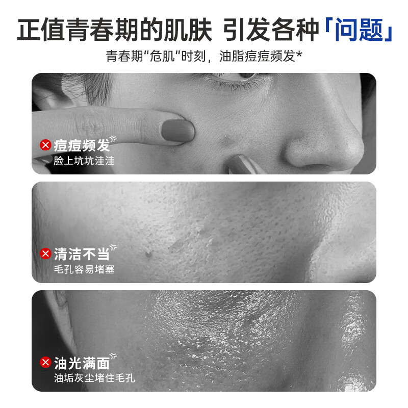 袋鼠杰克青少年儿童控油清痘洗面奶男孩女孩儿童补水抗痘水乳精华面霜面膜 【控油清痘】青少年洁面乳100g*1