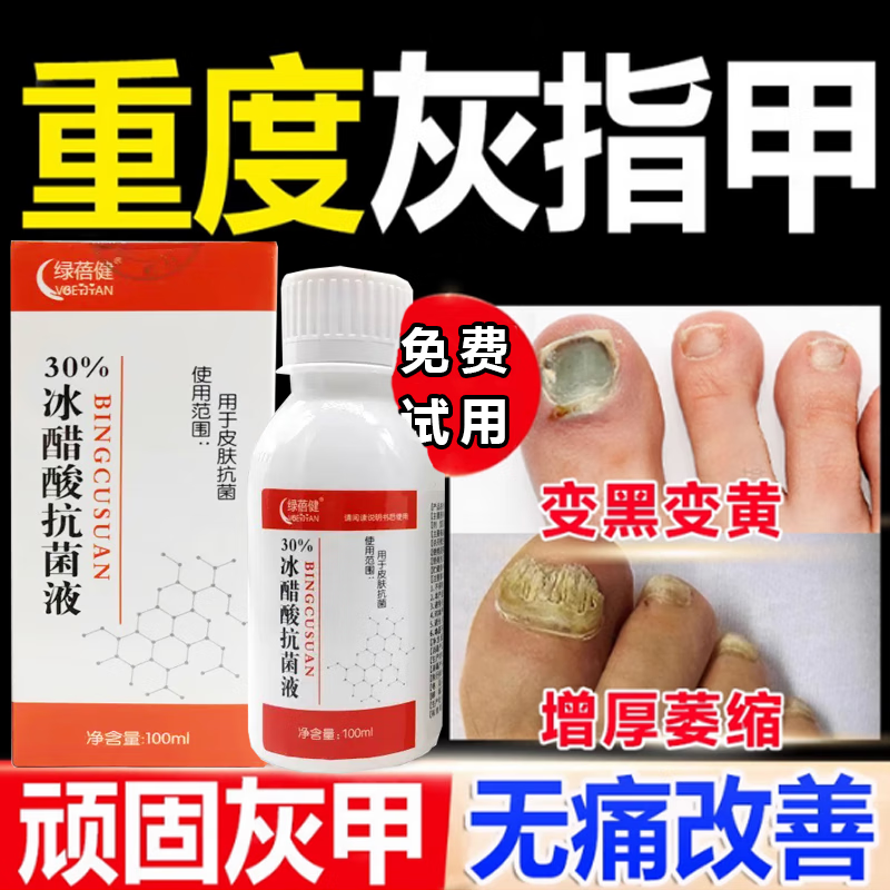 30%冰醋酸溶液灰指甲专用涂剂真菌感染抑菌脚部皮肤清洁角质灰指甲抗杀菌泡脚抑菌液 单盒体验装