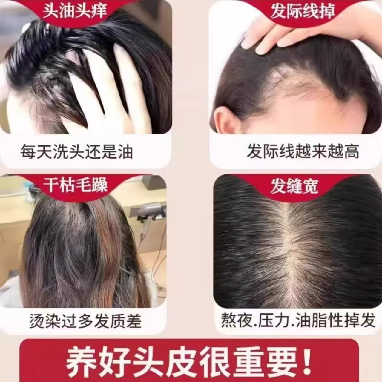 竹太医男女学生上学用洗护合一去屑止痒控油纯中药洗发膏 竹太医乌发固本保健膏300ml