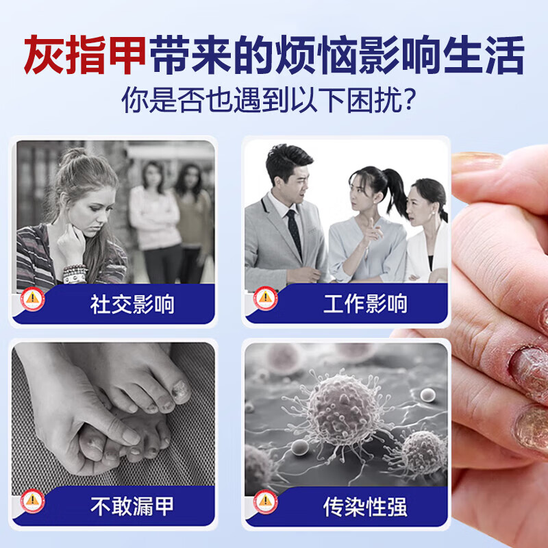 重度灰指甲100%特效专用的药特殊效专用抑菌液灰甲净套装 一盒【特效套装】1-2个灰甲选 灰指甲100%特效专用的药第一名