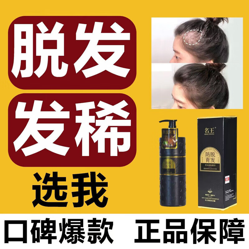 名王侧柏叶防脱育发洗发水控油蓬松何首乌洗发固发去屑止痒生发洗头膏 一瓶体验装【微微掉发体验看看】