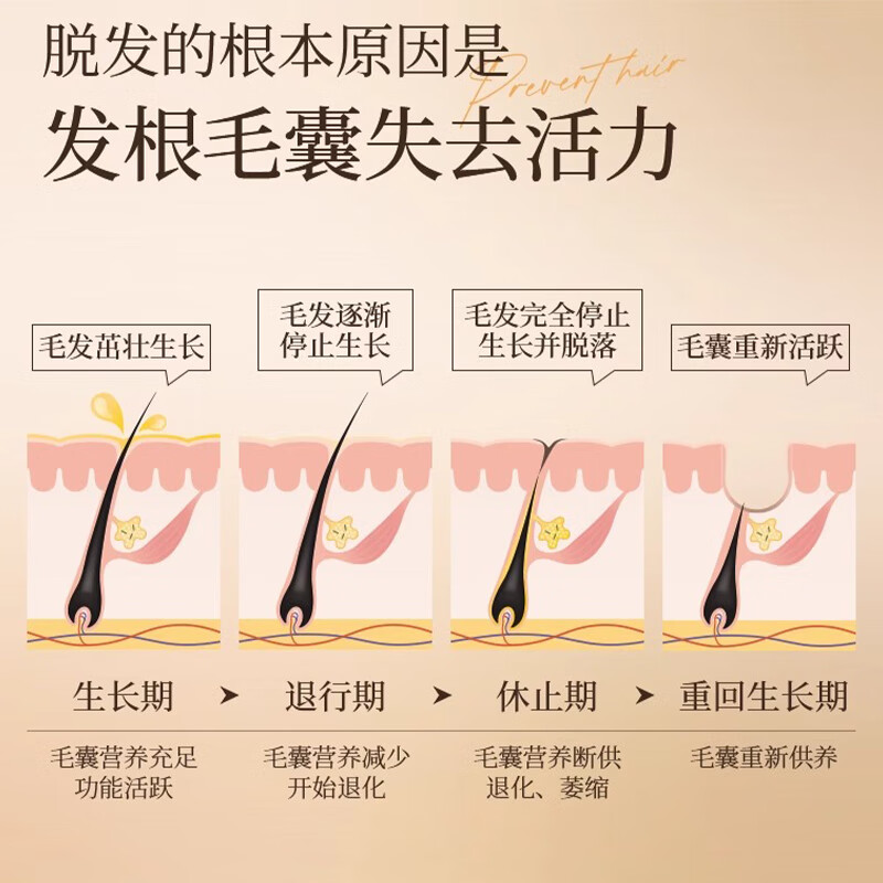 青幽堂苗坚防脱洗发水强韧育丰盈发际线洗发露控蓬松不油腻男女青幽棠 【建议多瓶使用】洗发水400g