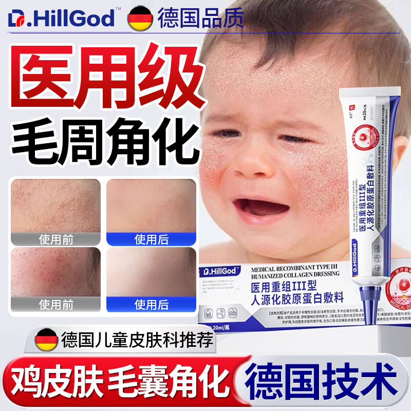 兒童毛周角化可搭藥專用臉部臉上起痘痘去雞皮膚疙瘩軟化毛囊角化癥臉上有小顆粒毛囊炎可搭沐浴露身體乳N3 一盒裝雞皮膚疙瘩毛囊角化 3歲