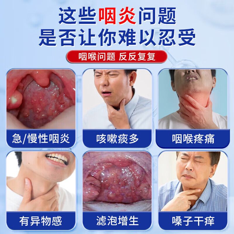 怡美堂北京同仁堂急慢性咽喉炎扁桃体炎咽喉肿痛的辅助治疗咽炎贴嗓子痒 3盒装【实付2盒】急慢性咽炎扁桃体炎