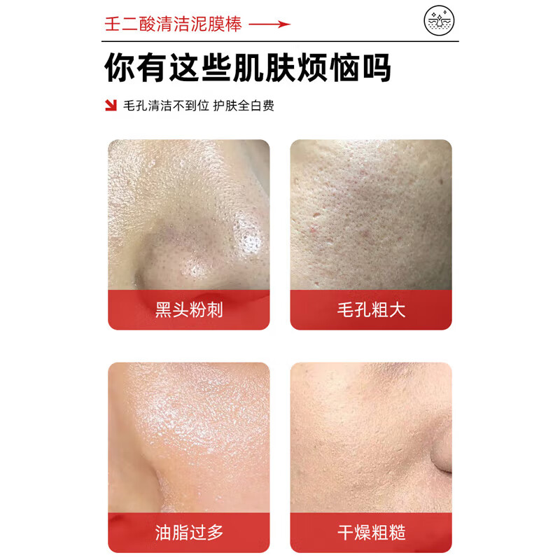 佰束壬二酸清洁泥膜棒去黑头油脂粉刺干燥面部涂抹面膜男女旋转便捷 40g*1瓶/