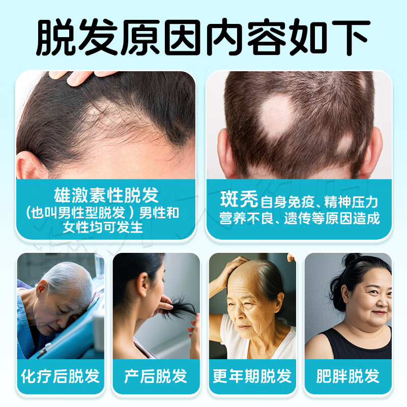 [惯爱]米诺地尔搽剂 2%*60ml 1盒装 官方正品米诺地尔2%女士专用治脱发高效生发育发斑秃发际线增长液搽剂清爽不油腻 体验装1瓶用1月