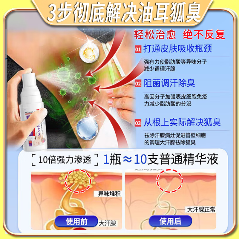 岩井昃弘狐臭100%药腋臭根除去油耳型狐臭液遗传狐臭净男士女士专用止汗露 特效:买2送1【一喷见校】 腋下异味狐臭净味液氯化羟铝正品