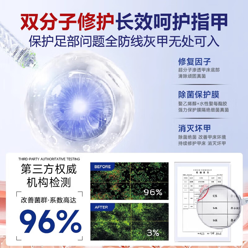 重度灰指甲100%特效专用的药特殊效专用抑菌液灰甲净套装 一盒【特效套装】1-2个灰甲选 灰指甲100%特效专用的药第一名