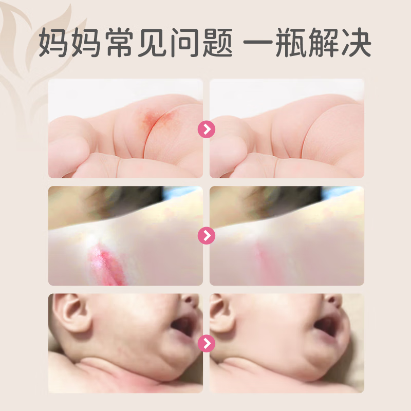宝莉康柠特护紫草油婴儿紫草油红屁屁专用护臀膏宝宝护臀霜 【93%顾客选择】特护紫草油38ml