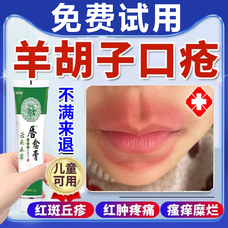 儿童舔嘴唇羊胡子疮须疮专用膏药儿童口周炎皮炎唇炎嘴巴周围红肿嘴唇
