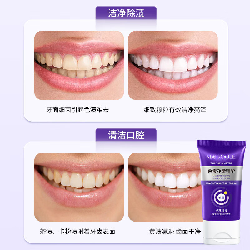 MaigooleMAIGOOLE色修净齿精华牙膏去渍去黄美牙除臭护龈固齿防敏感持久清 两支装