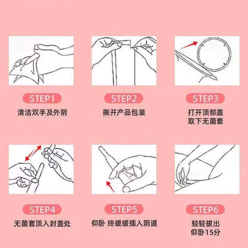 修正卡波姆妇用凝胶5支/盒阴道炎宫颈炎外阴瘙痒私处异味白带异常 3盒【卡波姆妇用凝胶】 5支/盒