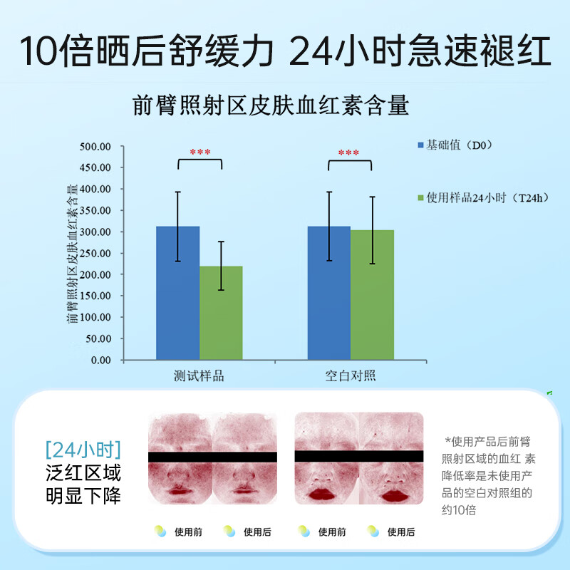 润贝舒婴儿夏季面霜儿童面霜新生儿宝宝儿童面霜补水保湿身体乳 夏季冰感降温霜50g