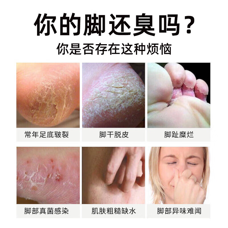 香港大药房联合集团有限公司香脚王脚气喷雾剂脚臭脚痒脚出汗脱皮水泡软膏烂臭脚搭配套装一喷一抹清爽呵护 2套【2盒喷剂+2盒乳膏】