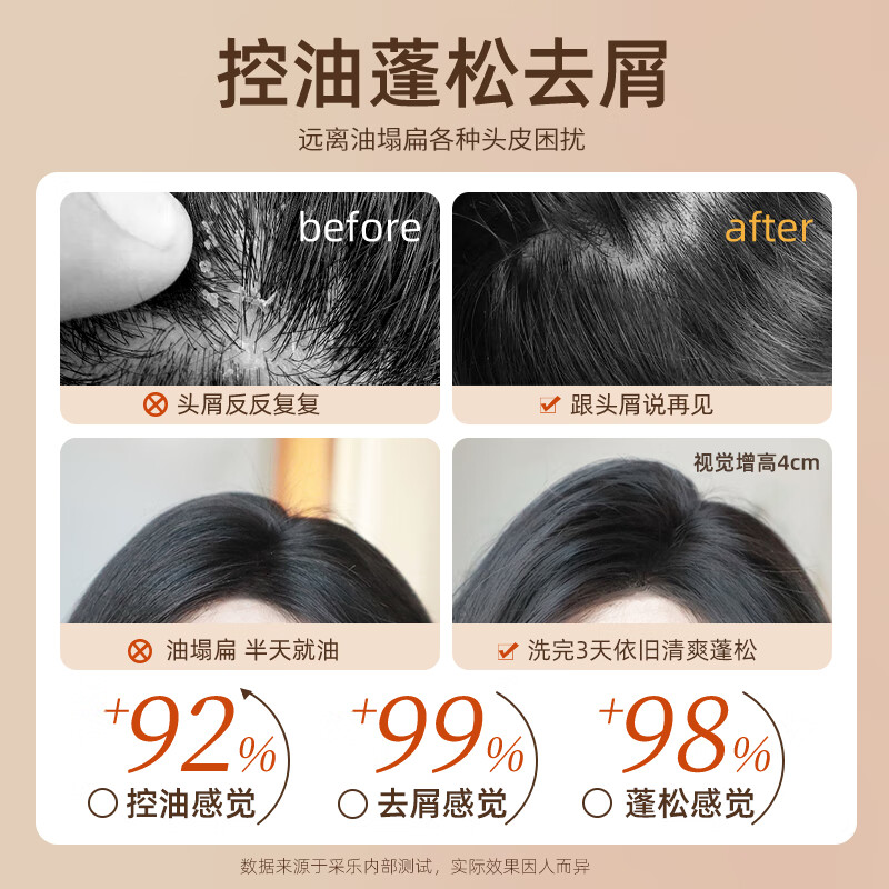采乐控油洗发水清爽蓬松去屑洗发露丰盈蓬松白松露洗发乳高颅顶 【控油蓬松】白松露洗发水 500ml*1瓶