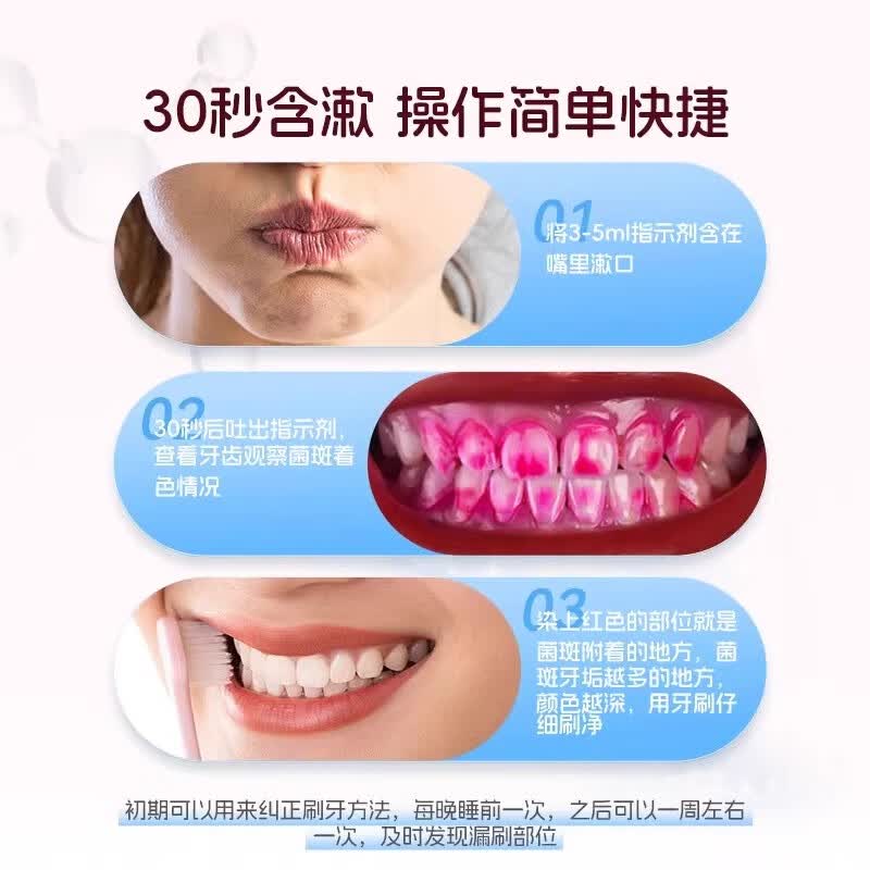 优利特儿童牙菌斑显示剂指示剂口腔测试祛除牙膏染色剂 60ml菌斑指示剂*3瓶