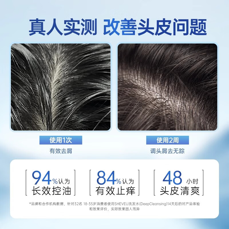 SELSUN澳洲二硫化硒洗发水男女士赛逸去屑蓬松无硅油止痒洗发露洗头膏 【升级款紫瓶】深层清洁200ml