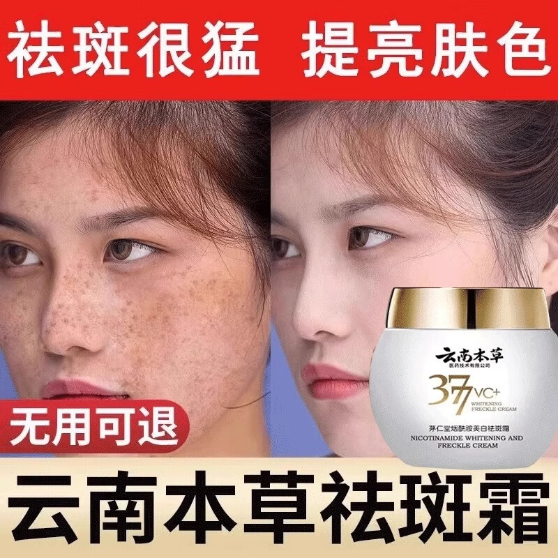 玫优姿尚品美白祛斑精华霜377滋润补水去黄抑制黑色素均匀肤色淡化痘印 1瓶 【轻度黄黑斑点】