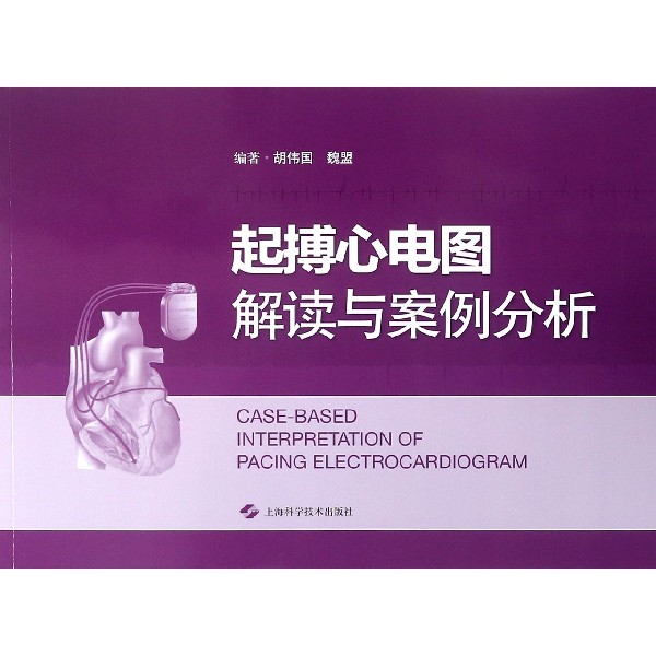 起搏心电图解读与案例分析