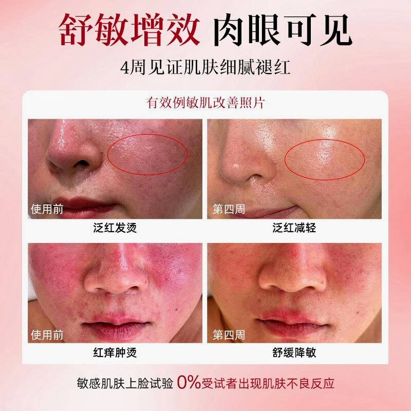 【旗舰直售】冰萃美红没药醇精华油修红舒敏养护角质以油养肤 红没药醇精华油1瓶