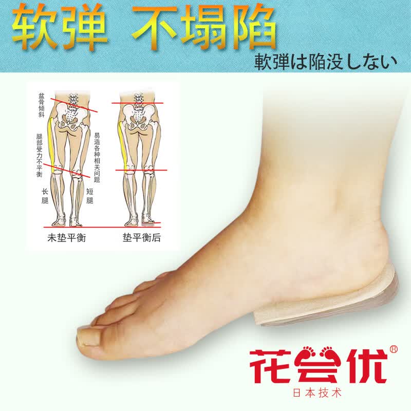 花会优长短腿矫正鞋垫高低脚短脚脊柱侧弯骨盆高低肩调节下肢不等长专用 4层/2cm【送2层】 M号30-38码